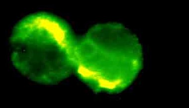 Two IL2 positive CD4+ T cells (fluorescence microscope picture)